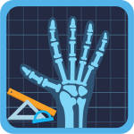 Orthopedic Angles Calculator