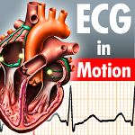 ECGinMotion ECGinMotion
